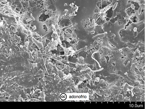 Sand biofilm